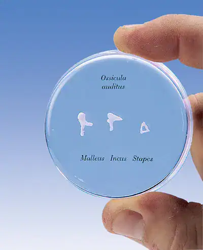 1000253 Gehoorbeentjes